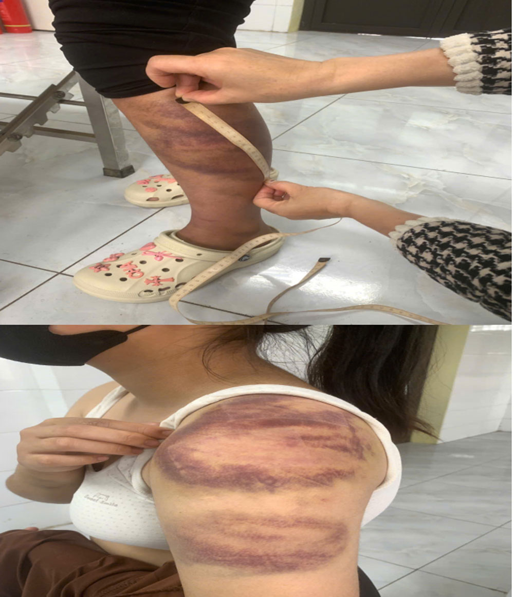 Bắc Ninh: Tạm giữ người chồng nhiều lần bạo hành vợ đang mang thai và con gái 13 tuổi