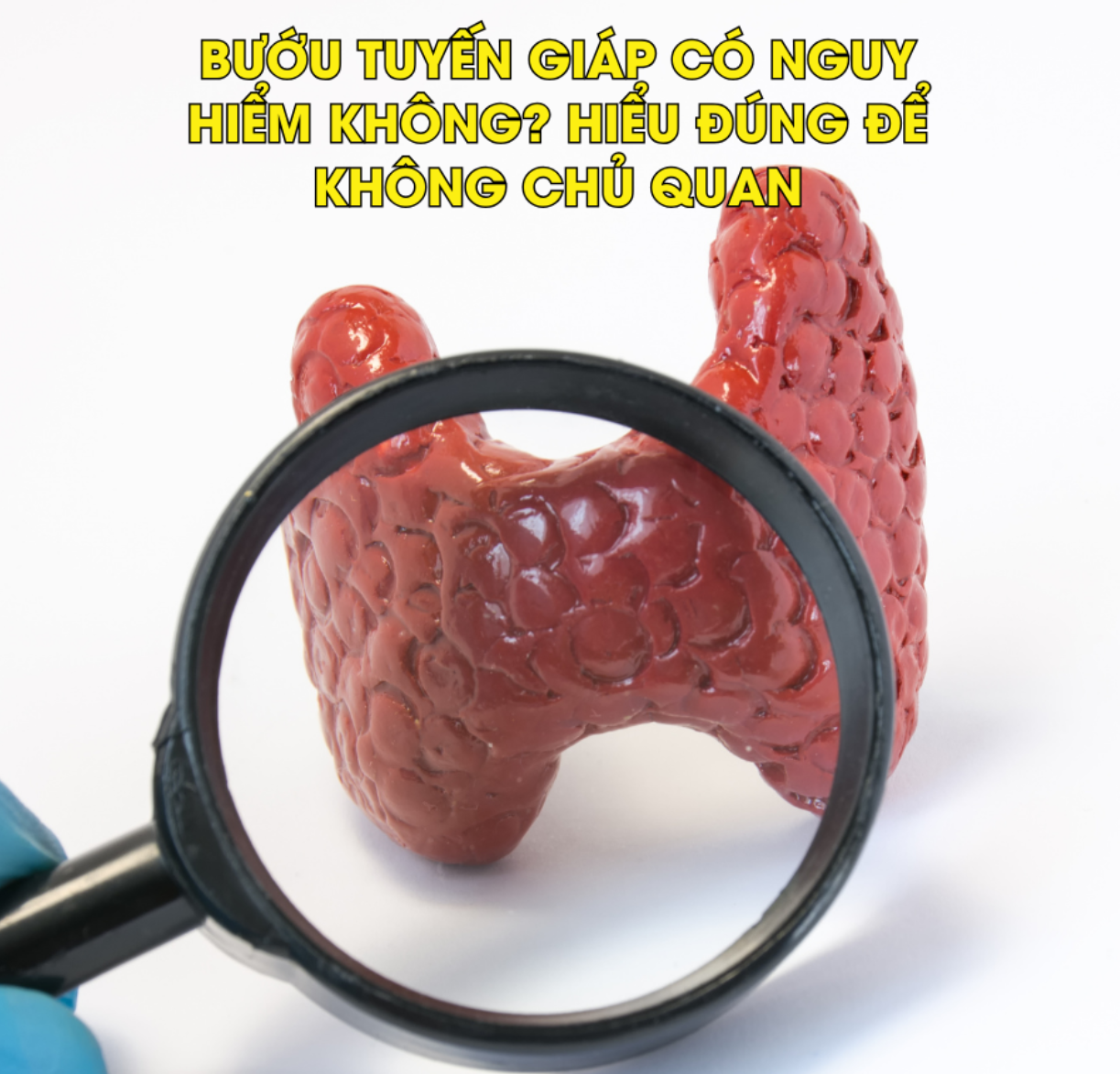 Bướu tuyến giáp có nguy hiểm không? Hiểu đúng để không chủ quan