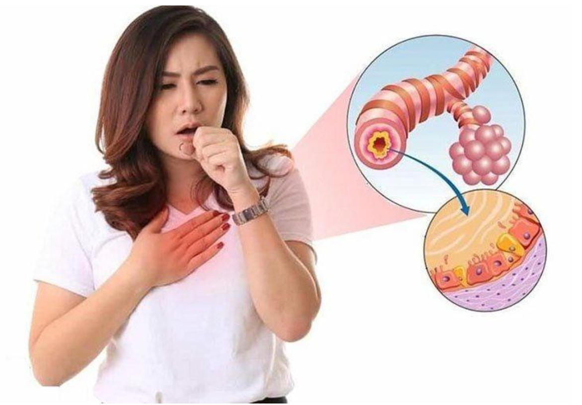 Vi&ecirc;m phổi mạn t&iacute;nh l&agrave; qu&aacute; tr&igrave;nh t&iacute;ch lũy tổn thương ở phổi qua nhiều năm