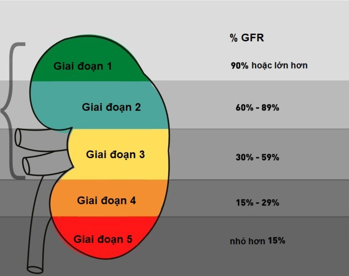 eGFR qua 5 cấp độ suy thận eGFR qua 5 cấp độ suy thận