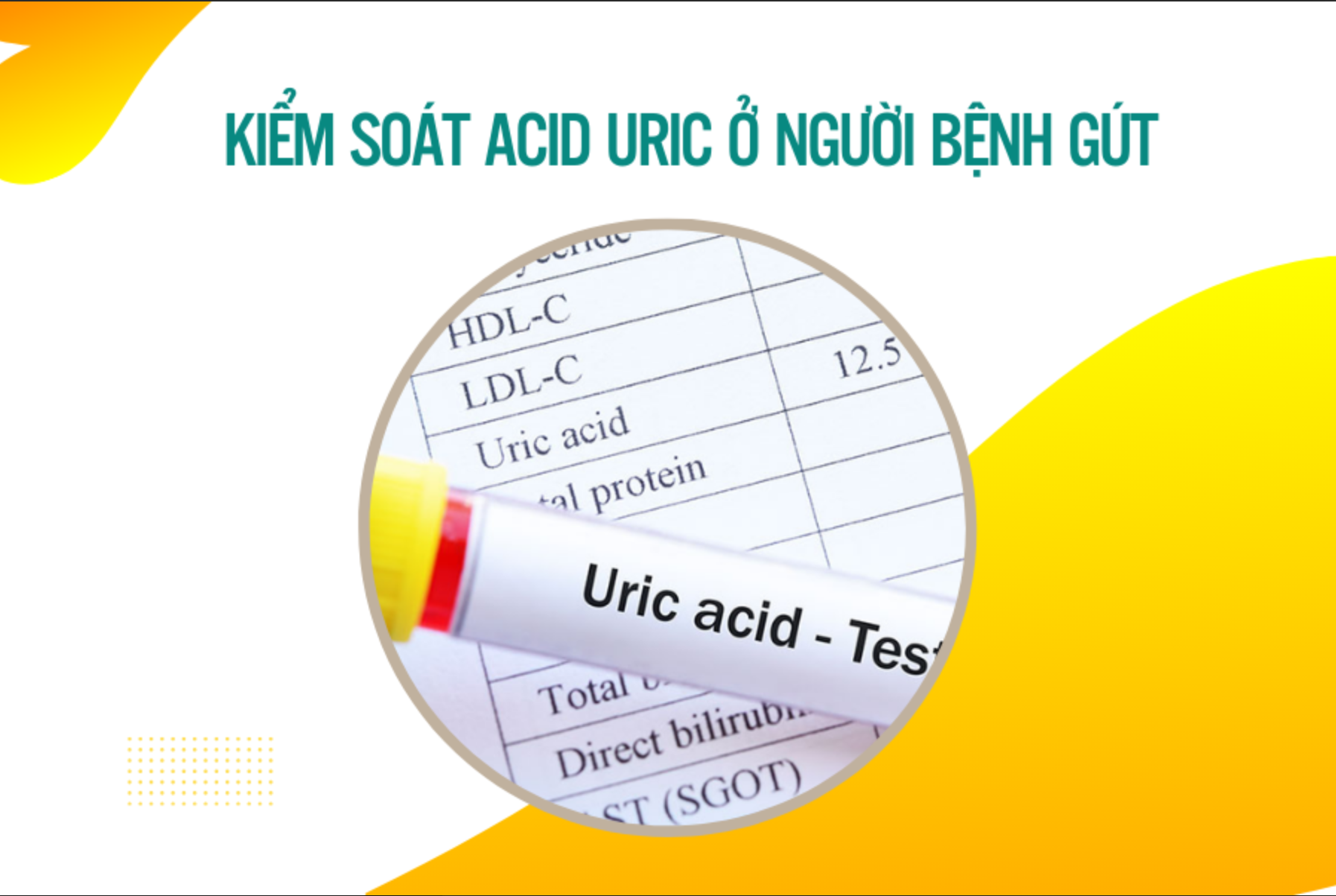 Kiểm soát acid uric ở người bệnh gút - chìa khóa hạn chế tái phát cơn đau