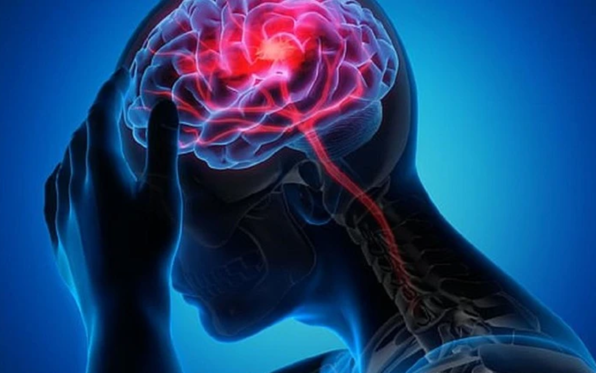 Rối loạn tuần ho&agrave;n m&aacute;u v&ugrave;ng đầu v&agrave; cổ l&agrave; nguy&ecirc;n nh&acirc;n g&acirc;y &ugrave; tai kiểu mạch đập