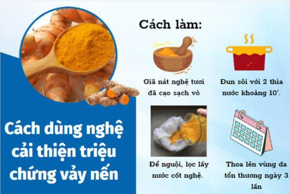Hoạt chất curcumin ở trong nghệ c&oacute; t&aacute;c dụng chống vi&ecirc;m hiệu quả