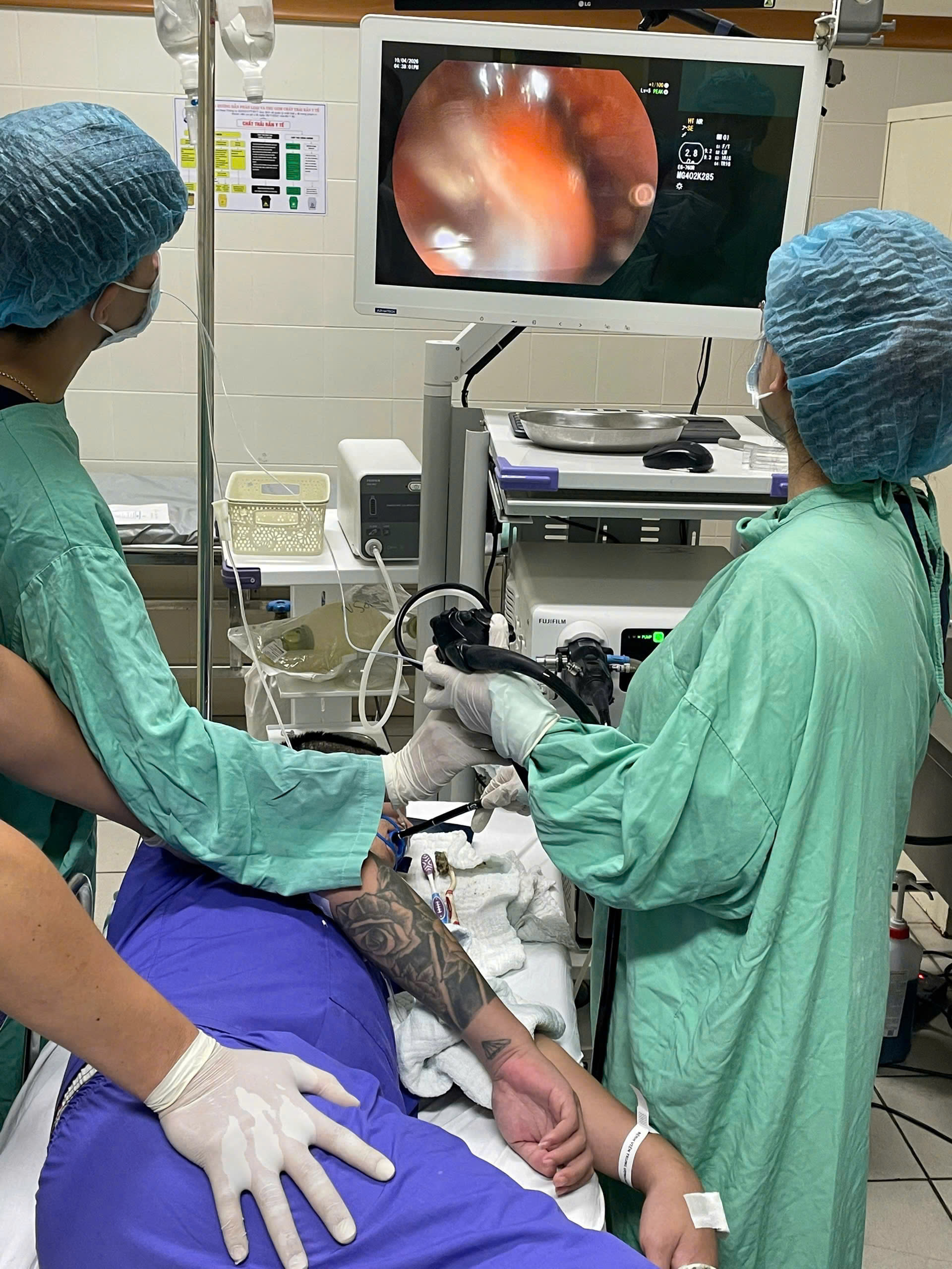 Gắp 3 bàn chải đánh răng trong đường tiêu hóa của thanh niên 29 tuổi