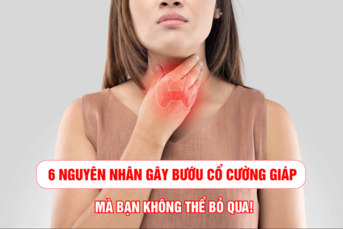 6 nguyên nhân gây cường giáp mà bạn nhất định phải biết