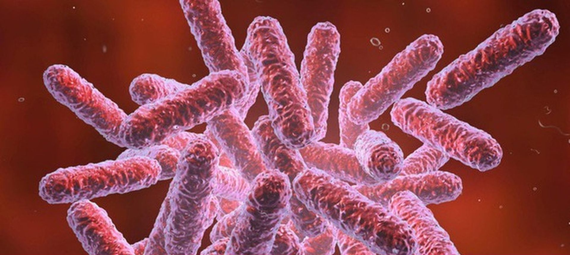 Theo chuy&ecirc;n gia, người mắc bệnh Melioidosis hay 