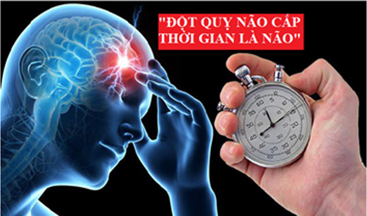 Tầm quan trọng của việc điều trị đột quỵ tại địa phương nhằm tận dụng "giờ vàng"