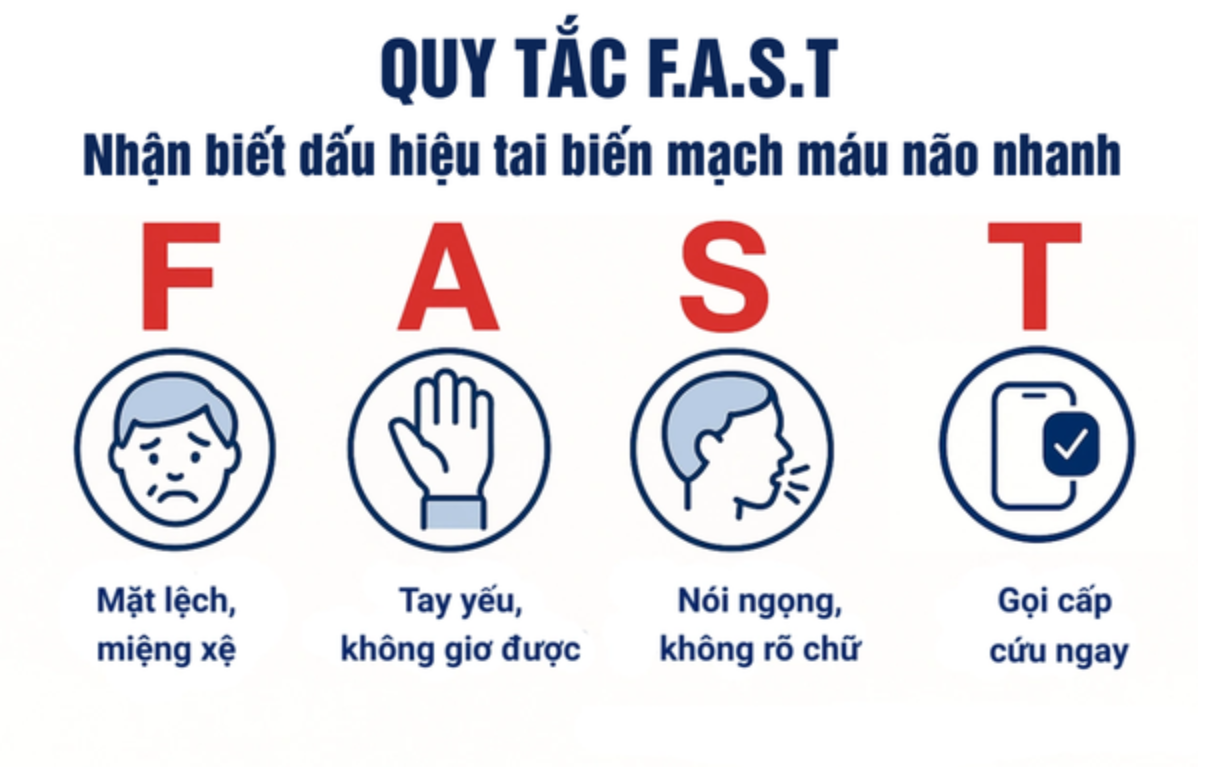 Quy tắc FAST l&agrave; c&aacute;ch đơn giản gi&uacute;p nhận diện sớm tai biến mạch m&aacute;u n&atilde;o