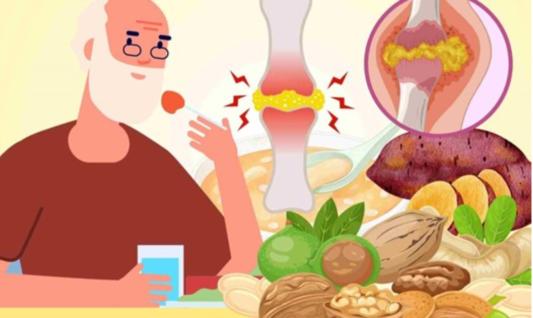 Thay đổi th&oacute;i quen h&agrave;ng ng&agrave;y l&agrave;nh mạnh hơn cũng gi&uacute;p kiểm so&aacute;t acid uric m&aacute;u