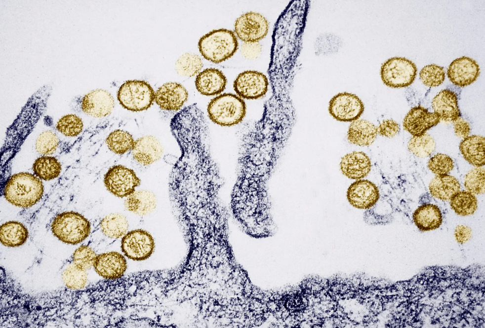 Virus Hanta khiến 3 người tử vong, Bộ Y tế phát cảnh báo khẩn