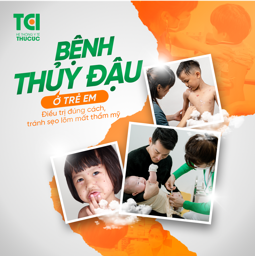 Thủy đậu không phải là bệnh lành tính và nguy cơ biến chứng nghiêm trọng ở trẻ em