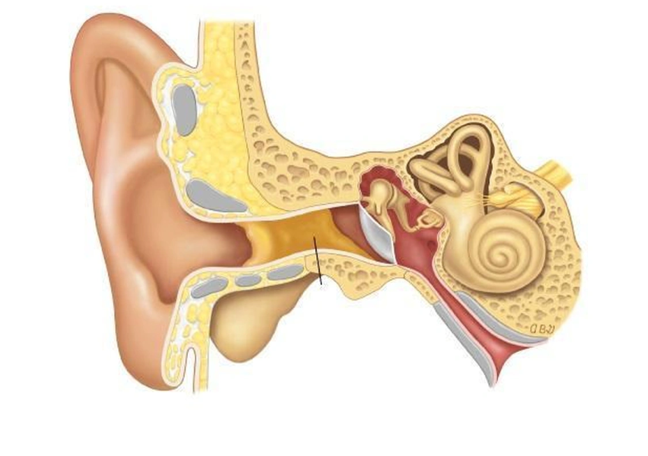 Ù tai do hệ thần kinh thính giác hoạt động kém Ù tai do hệ thần kinh thính giác hoạt động kém
