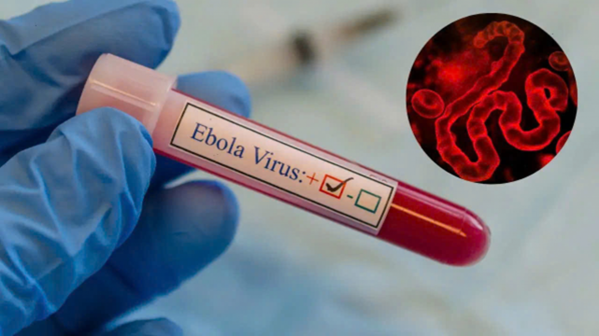 Ebola lây lan nhanh, tử vong tới 90%, Bộ Y tế yêu cầu tăng cường giám sát