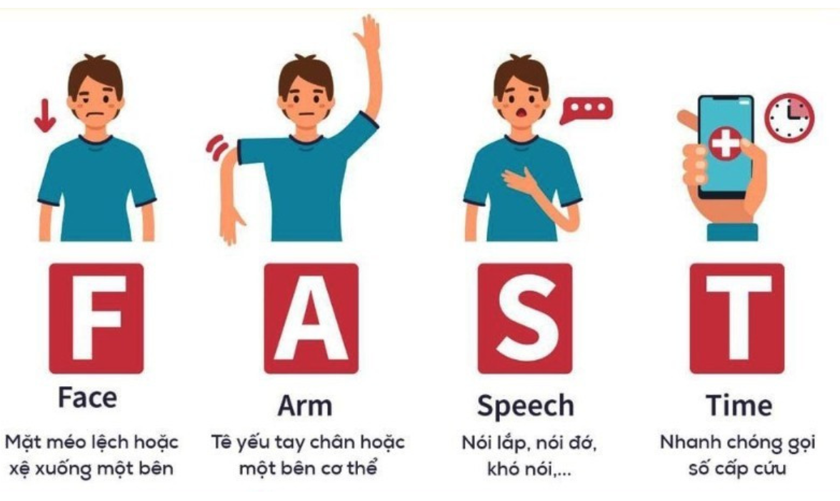 Quy tắc FAST gi&uacute;p nhận biết nhanh cơn tai biến mạch m&aacute;u n&atilde;o