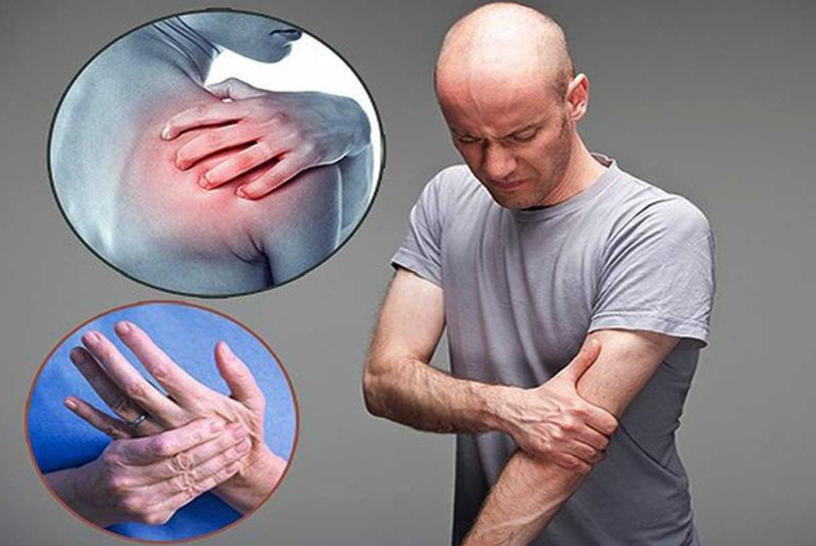 Tê bì vai và cánh tay là biểu hiện của thoái hóa đốt sống cổ C4 C5 chèn ép rễ dây thần kinh Tê bì vai và cánh tay là biểu hiện của thoái hóa đốt sống cổ C4 C5 chèn ép rễ dây thần kinh