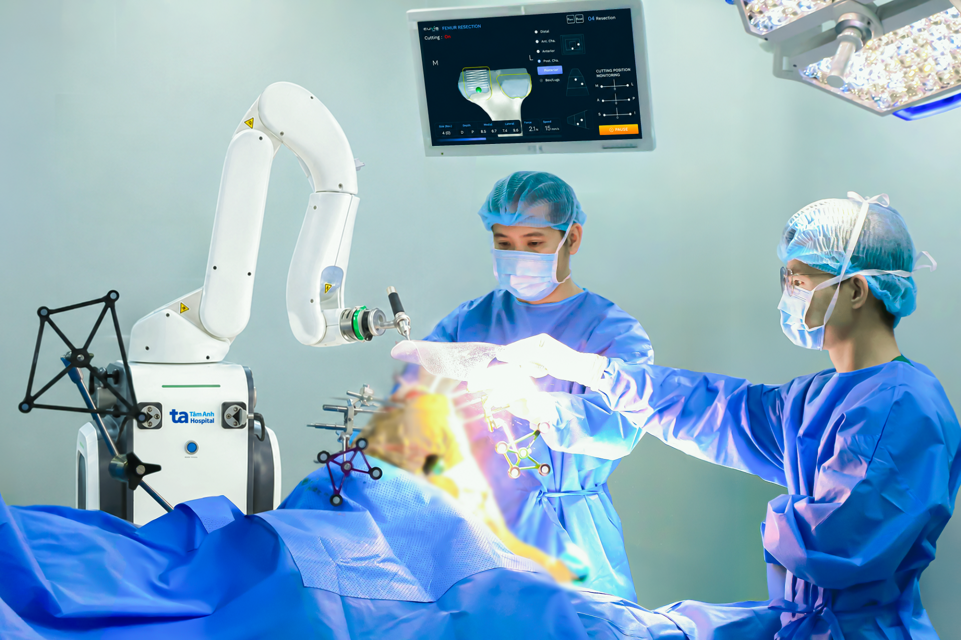 B&aacute;c sĩ đang d&ugrave;ng robot AI CUVIS-Joint phẫu thuật thay khớp cho người bệnh. Ảnh: Bệnh viện Đa khoa T&acirc;m Anh