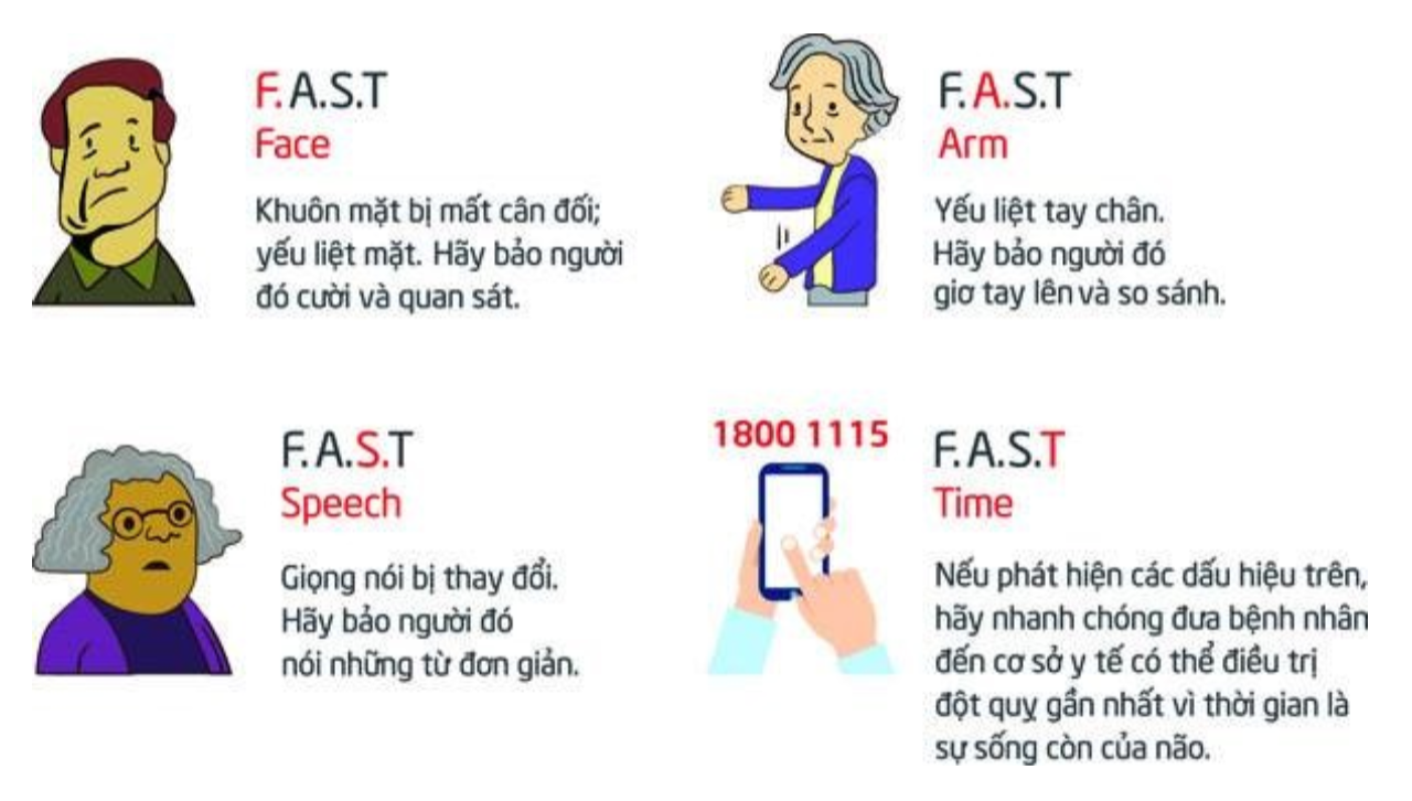 Quy tắc FAST gi&uacute;p nhận biết dấu hiệu sớm của nhồi m&aacute;u n&atilde;o