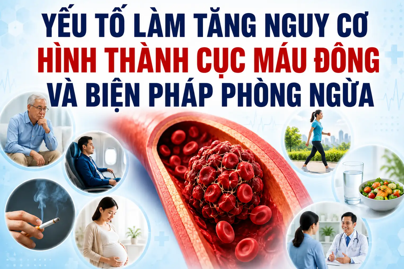 Yếu tố làm tăng nguy cơ hình thành cục máu đông và biện pháp phòng ngừa