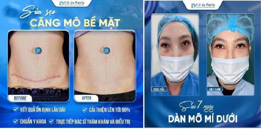 Phòng khám triển khai nhiều nhóm dịch vụ tạo hình thẩm mỹ theo danh mục kỹ thuật được cấp phép. Phòng khám triển khai nhiều nhóm dịch vụ tạo hình thẩm mỹ theo danh mục kỹ thuật được cấp phép.