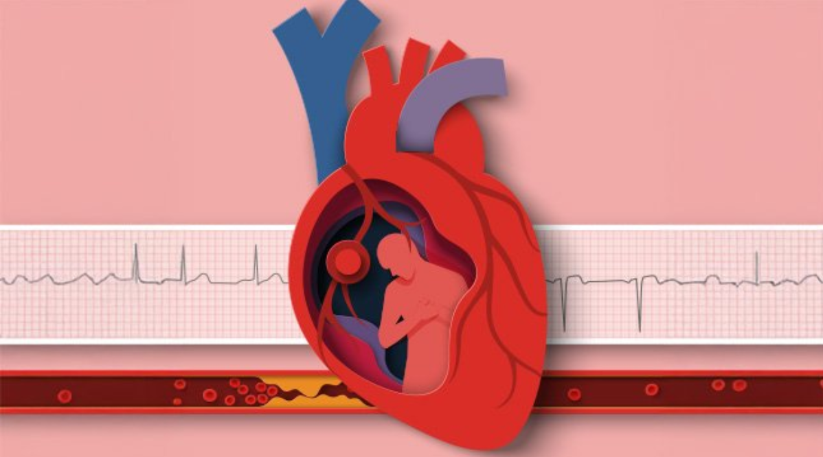 Tăng huyết áp có thể gây ra nhiều biến chứng nguy hiểm Tăng huyết áp có thể gây ra nhiều biến chứng nguy hiểm