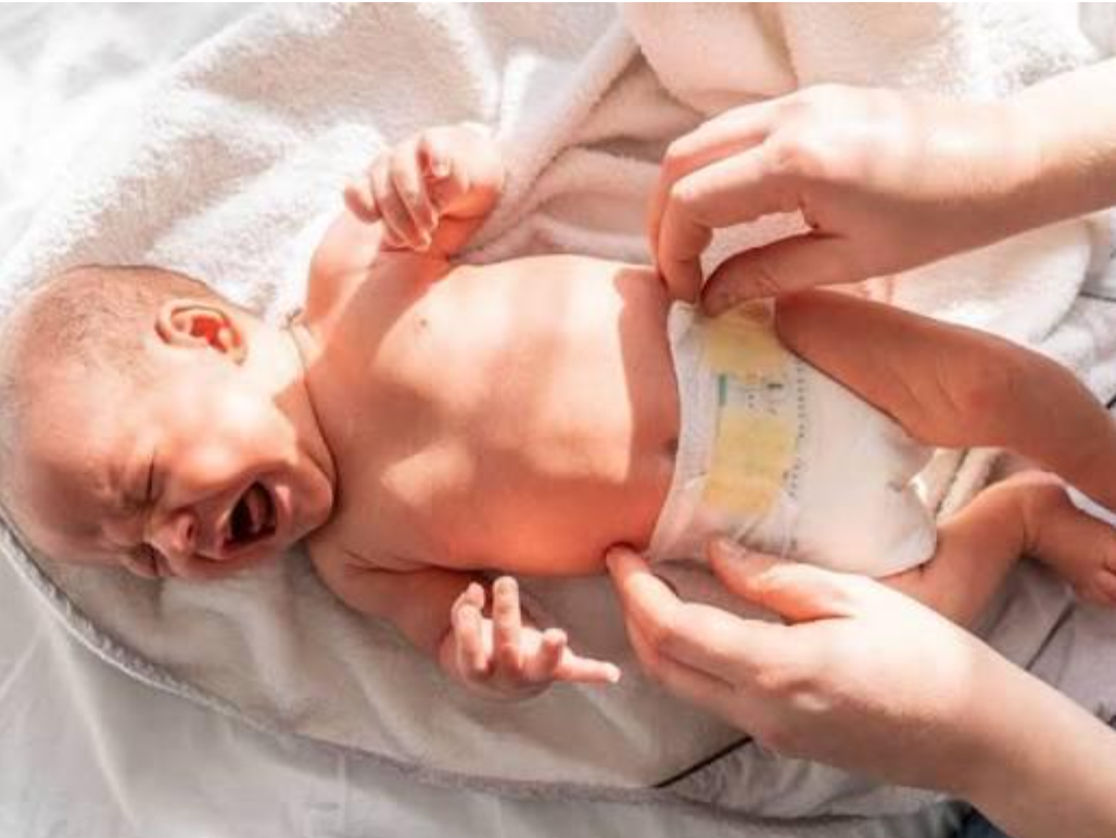 Hăm t&atilde; ảnh hưởng đ&aacute;ng kể đến sinh hoạt v&agrave; t&acirc;m trạng của trẻ