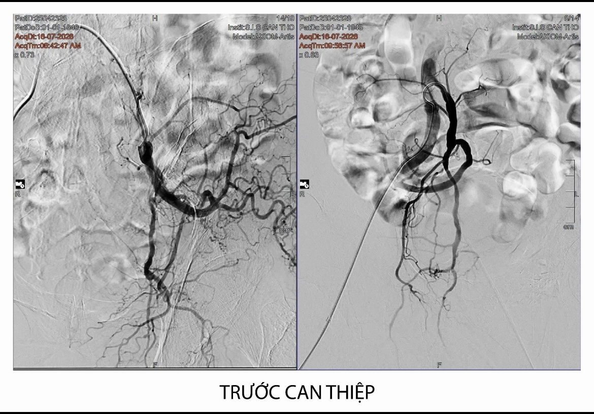 Hình ảnh trước khi can thiệp Hình ảnh trước khi can thiệp