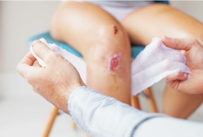 Nh&acirc;n vi&ecirc;n y tế của ph&ograve;ng kh&aacute; gia đ&igrave;nh Việt &Uacute;c gi&uacute;p chăm s&oacute;c vết thương một c&aacute;ch tối ưu.