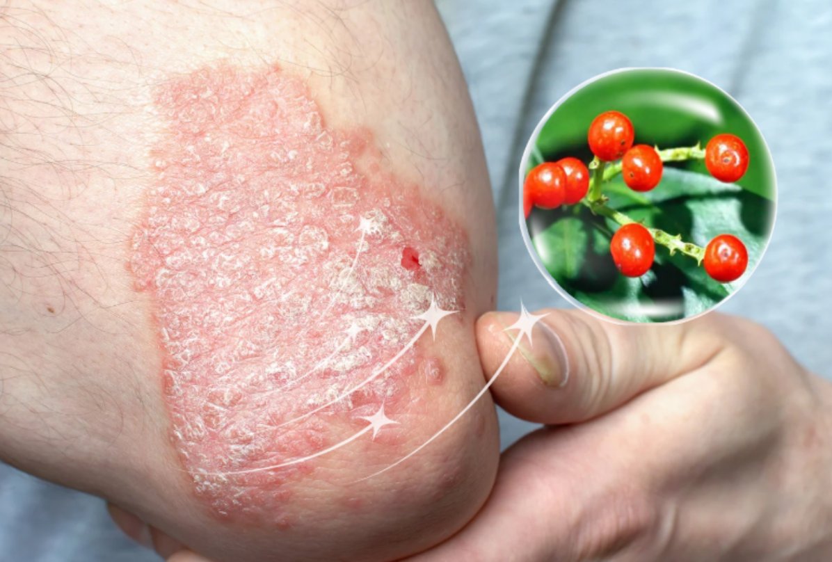 Sói rừng giúp điều hòa miễn dịch từ bên trong, giúp kiểm soát vảy nến lâu dài Sói rừng giúp điều hòa miễn dịch từ bên trong, giúp kiểm soát vảy nến lâu dài