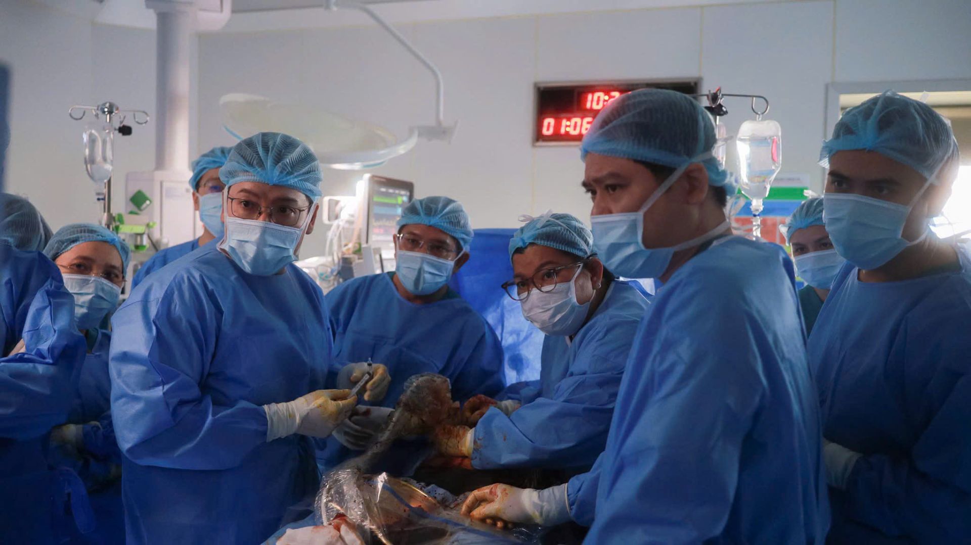 Ê-kíp liên viện Từ Dũ - Nhi Đồng 1 khẩn trương hội chẩn, đưa ra các quyết định kỹ thuật cân não ngay tại bàn mổ khi tim thai gặp biến chứng bất ngờ. Ê-kíp liên viện Từ Dũ - Nhi Đồng 1 khẩn trương hội chẩn, đưa ra các quyết định kỹ thuật cân não ngay tại bàn mổ khi tim thai gặp biến chứng bất ngờ.