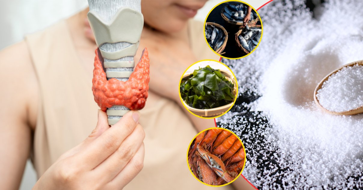 Người bị bướu cổ nên bổ sung các thực phẩm giàu i-ốt tự nhiên như cá biển, tôm, cua, rong biển Người bị bướu cổ nên bổ sung các thực phẩm giàu i-ốt tự nhiên như cá biển, tôm, cua, rong biển